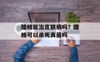 醋精能治皮肤病吗？醋精可以杀死真菌吗