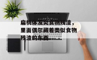 扁桃体发炎食物残渣，里面偶尔藏着类似食物残渣的东西